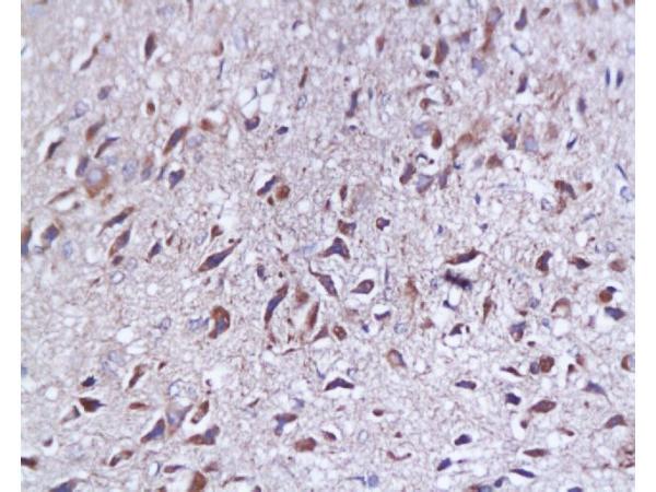 SYAP1 Antibody in Immunohistochemistry (Paraffin) (IHC (P))