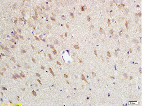 Neurokinin A Receptor Antibody in Immunohistochemistry (Paraffin) (IHC (P))