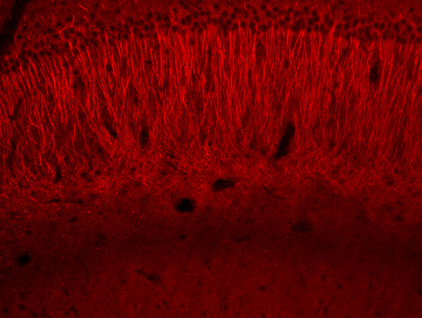 HSP70 Antibody in Immunohistochemistry (Paraffin) (IHC (P))