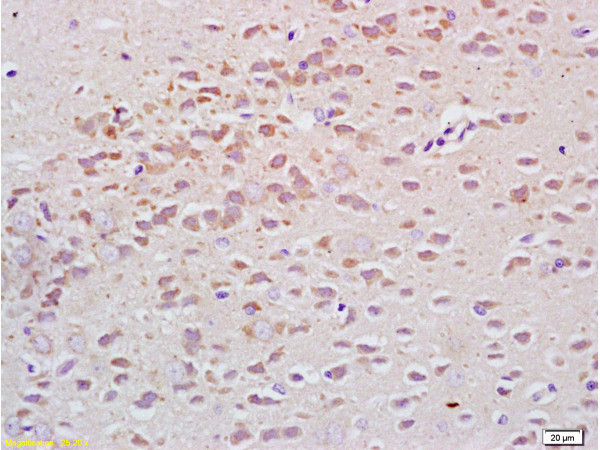 Tubulin-alpha Antibody in Immunohistochemistry (Paraffin) (IHC (P))