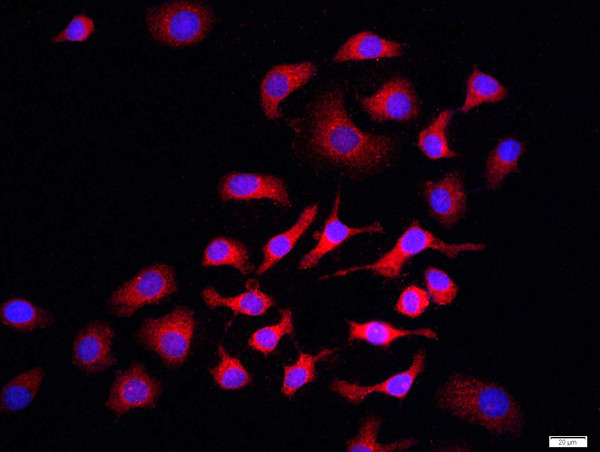 p75 NGF Receptor Antibody in Immunocytochemistry (ICC/IF)