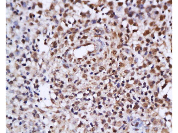 Estrogen Receptor alpha + beta Antibody in Immunohistochemistry (Paraffin) (IHC (P))