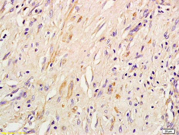 IRS-3 Antibody in Immunohistochemistry (Paraffin) (IHC (P))