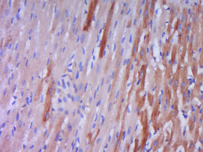 Preproendothelin 1 Antibody in Immunohistochemistry (Paraffin) (IHC (P))