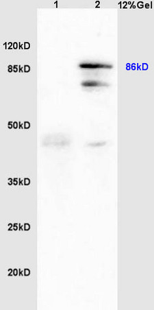 GRP94 Antibody in Immunohistochemistry (Paraffin) (IHC (P))