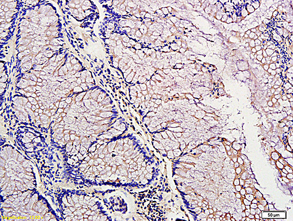PDGF A Antibody in Immunohistochemistry (Paraffin) (IHC (P))