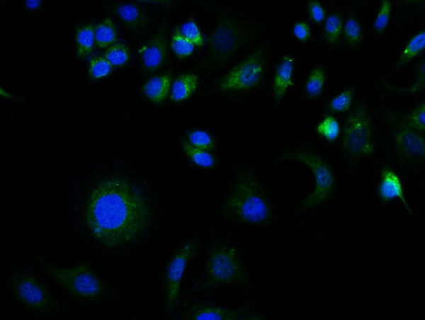 GFAP Antibody in Immunocytochemistry (ICC/IF)