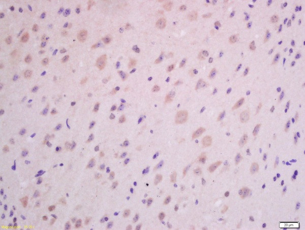 GHRH Antibody in Immunohistochemistry (Paraffin) (IHC (P))