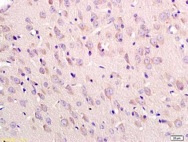 Tubulin-beta Antibody in Immunohistochemistry (Paraffin) (IHC (P))