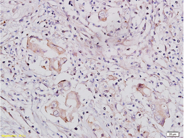 IGF1R Antibody in Immunohistochemistry (Paraffin) (IHC (P))