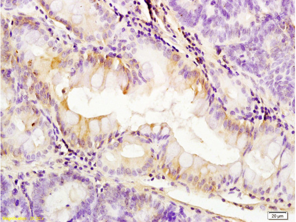 PDGFRA Antibody in Immunohistochemistry (Paraffin) (IHC (P))