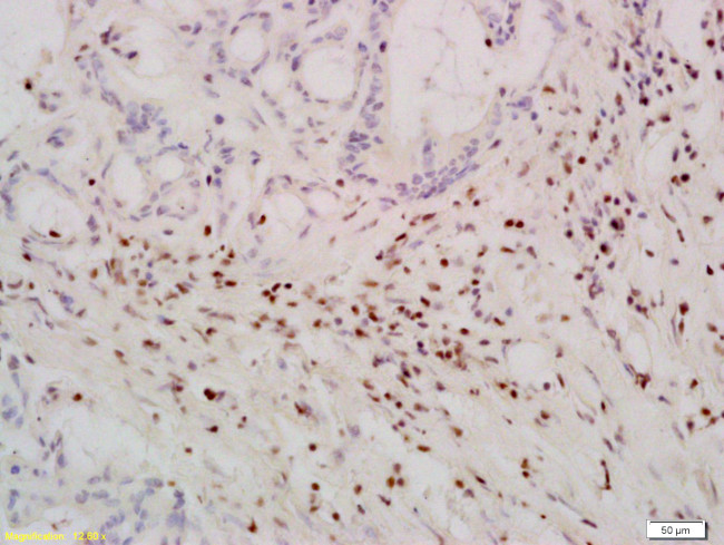 TERT Antibody in Immunohistochemistry (Paraffin) (IHC (P))