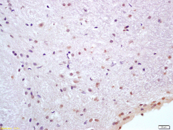 HSP70 1A/1B Antibody in Immunohistochemistry (Paraffin) (IHC (P))