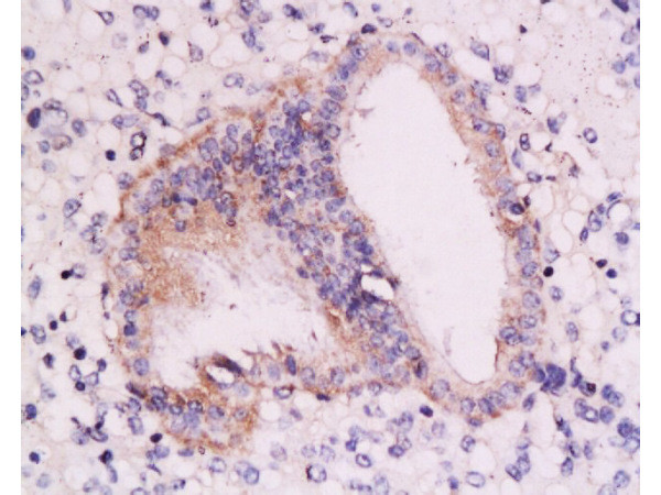 RAR alpha Antibody in Immunohistochemistry (Paraffin) (IHC (P))