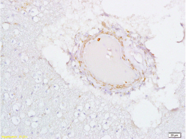 Estrogen receptor beta Antibody in Immunohistochemistry (Paraffin) (IHC (P))