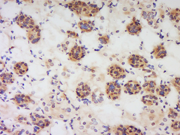 PBEF1 Antibody in Immunohistochemistry (Paraffin) (IHC (P))