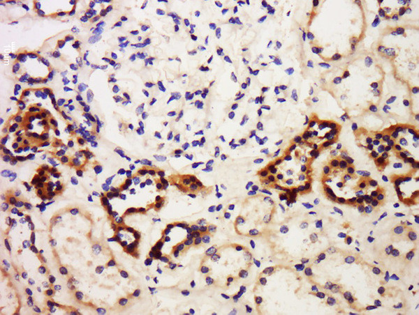 PBEF CT Antibody in Immunohistochemistry (Paraffin) (IHC (P))