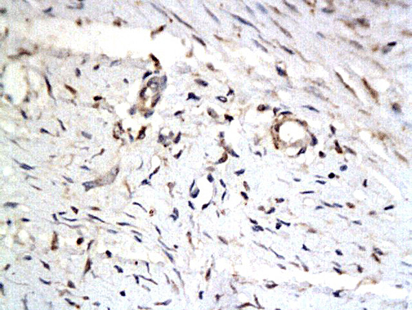 IASPP Antibody in Immunohistochemistry (Paraffin) (IHC (P))