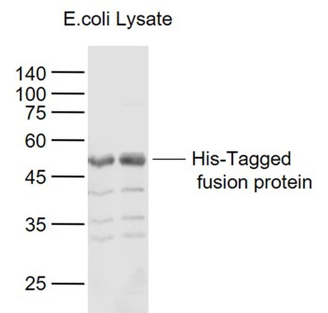 His Tag Antibody in Western Blot (WB)