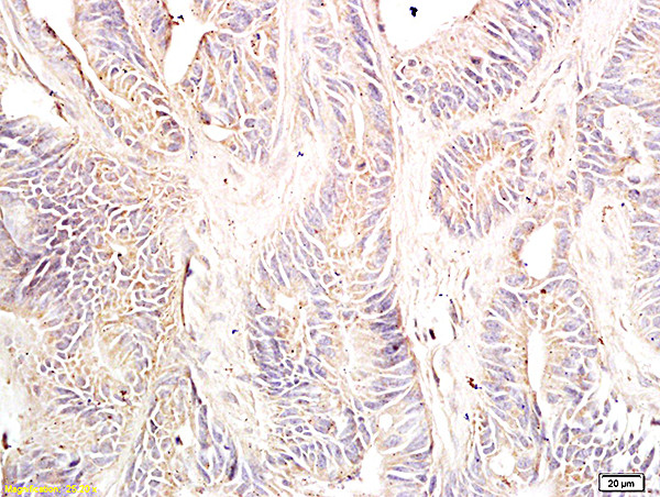 Dnmt3 Beta Antibody in Immunohistochemistry (Paraffin) (IHC (P))