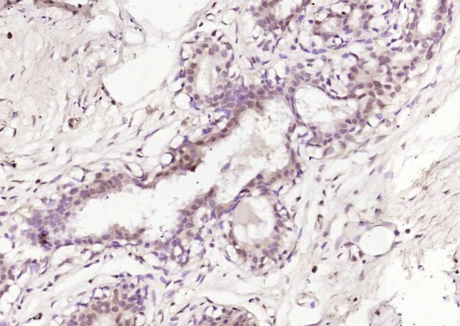 PADI4 Antibody in Immunohistochemistry (Paraffin) (IHC (P))