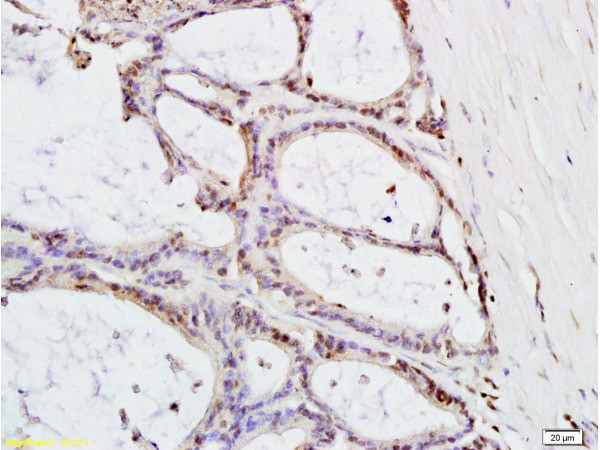 MTLC Antibody in Immunohistochemistry (Paraffin) (IHC (P))