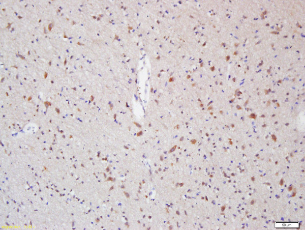 Myelin Protein Zero Antibody in Immunohistochemistry (Paraffin) (IHC (P))