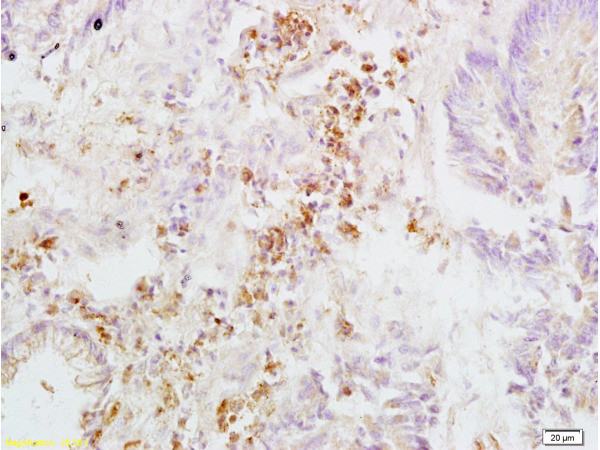 Integrin beta 3 Antibody in Immunohistochemistry (Paraffin) (IHC (P))