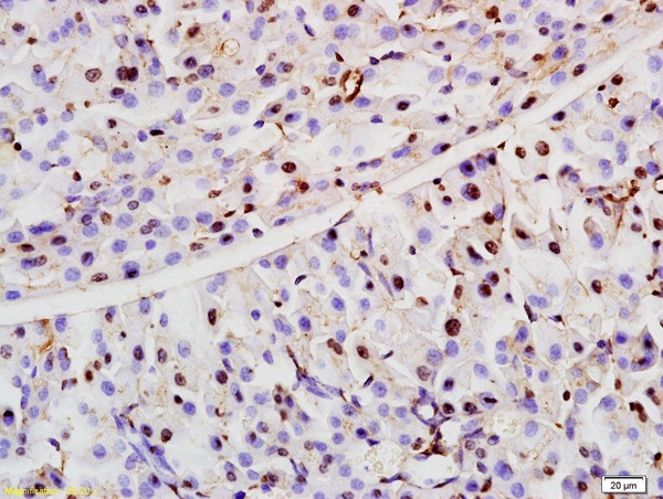 ZCWCC1 Antibody in Immunohistochemistry (Paraffin) (IHC (P))