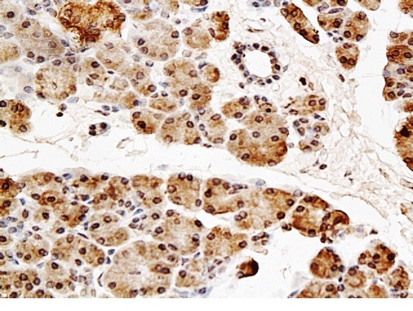 NT5C2 Antibody in Immunohistochemistry (Paraffin) (IHC (P))