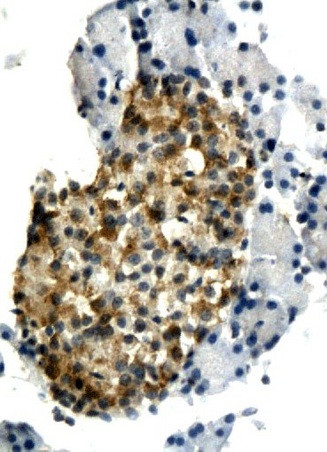 IL-6 Antibody in Immunohistochemistry (Paraffin) (IHC (P))