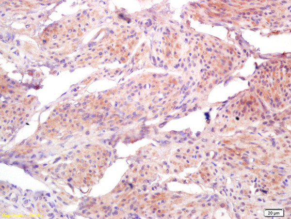 BRI3BP Antibody in Immunohistochemistry (Paraffin) (IHC (P))