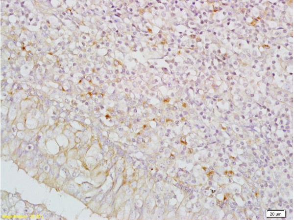 IGFBP5 Antibody in Immunohistochemistry (Paraffin) (IHC (P))