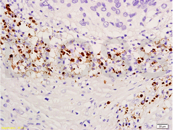 TIMP-4 Antibody in Immunohistochemistry (Paraffin) (IHC (P))