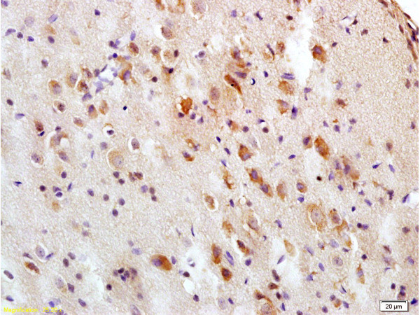 Tau protein Antibody in Immunohistochemistry (Paraffin) (IHC (P))