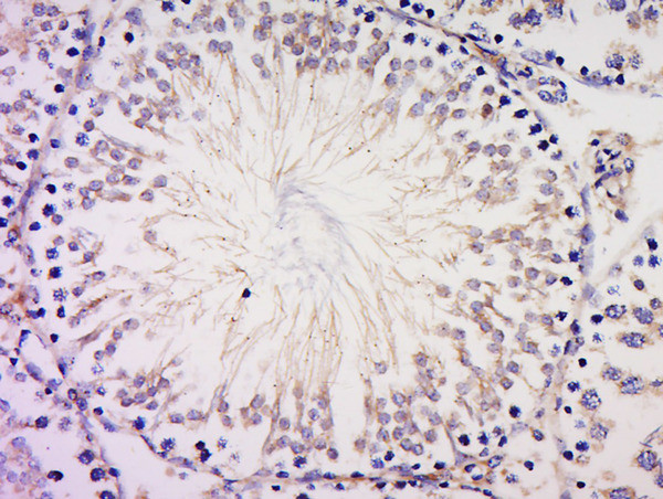 PIBF Antibody in Immunohistochemistry (Paraffin) (IHC (P))