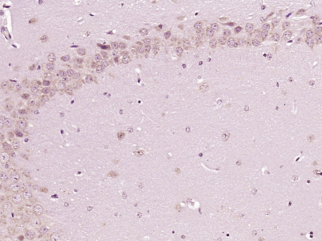 DISC1 NT Antibody in Immunohistochemistry (Paraffin) (IHC (P))
