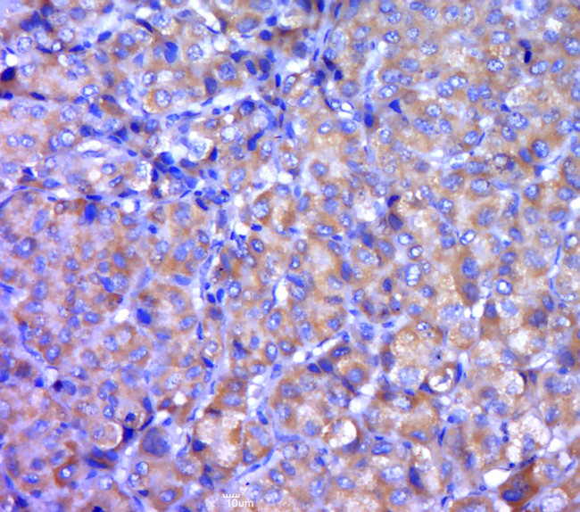 DISC1 CT Antibody in Immunohistochemistry (Paraffin) (IHC (P))