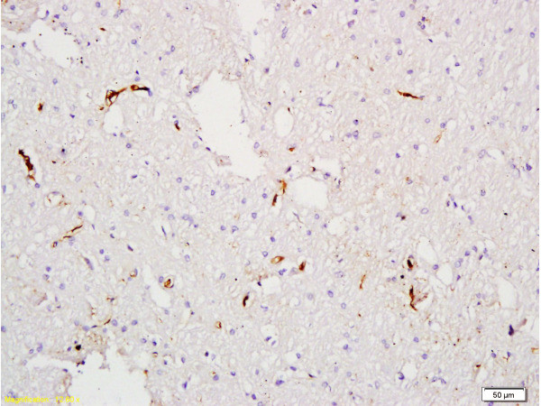Factor 8 Antibody in Immunohistochemistry (Paraffin) (IHC (P))