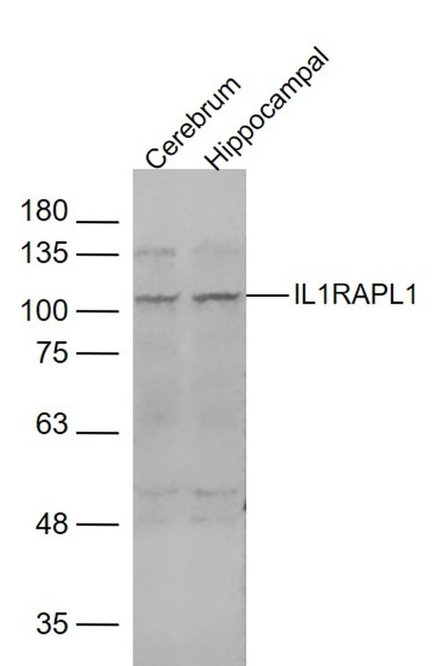 IL1RAPL1 Antibody in Western Blot (WB)