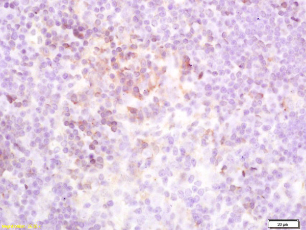 TSHR Antibody in Immunohistochemistry (Paraffin) (IHC (P))