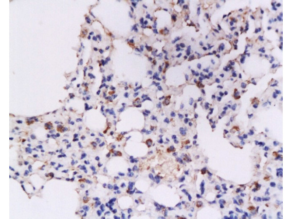 IFN gamma Antibody in Immunohistochemistry (Paraffin) (IHC (P))