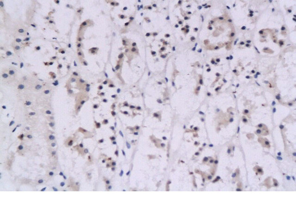 IFN gamma Antibody in Immunohistochemistry (Paraffin) (IHC (P))