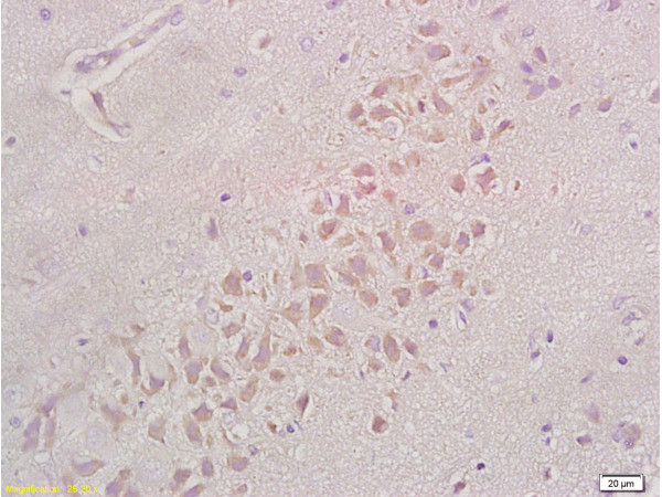 Integrin beta 1 Antibody in Immunohistochemistry (Paraffin) (IHC (P))