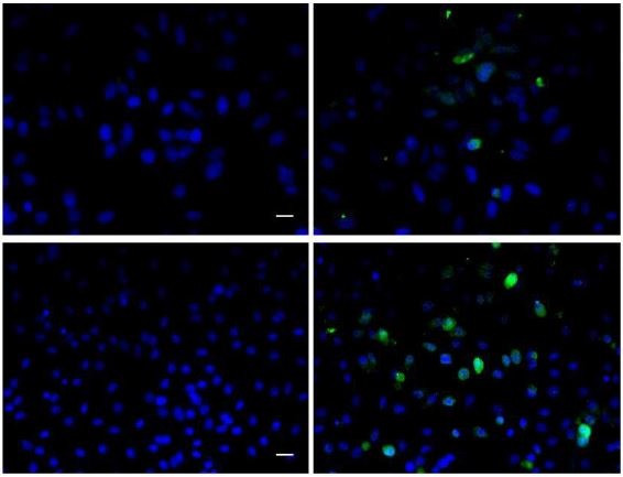 BrdU Antibody in Immunocytochemistry (ICC/IF)