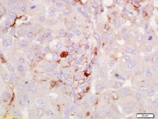 RGS2 Antibody in Immunohistochemistry (Paraffin) (IHC (P))