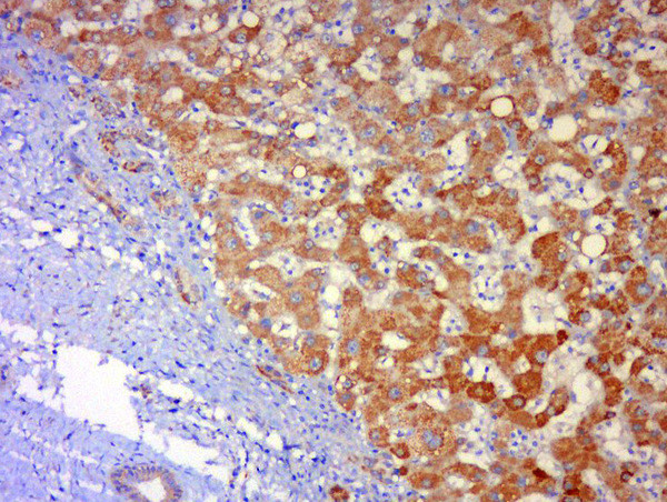 JNK1 + 3 Antibody in Immunohistochemistry (Paraffin) (IHC (P))