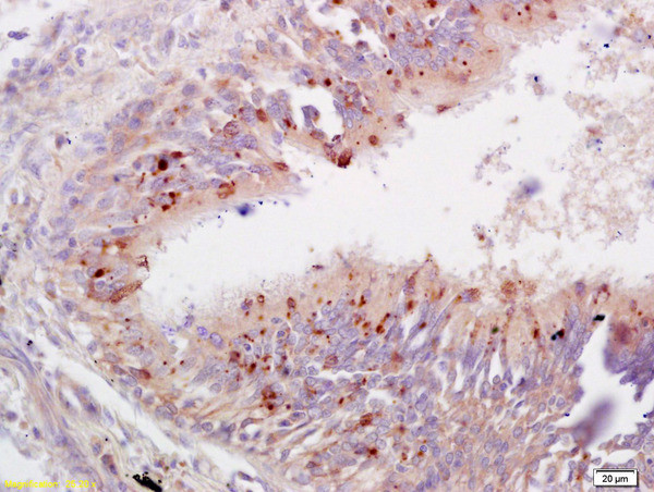 TBX2 Antibody in Immunohistochemistry (Paraffin) (IHC (P))