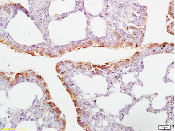 CD2AP Antibody in Immunohistochemistry (Paraffin) (IHC (P))