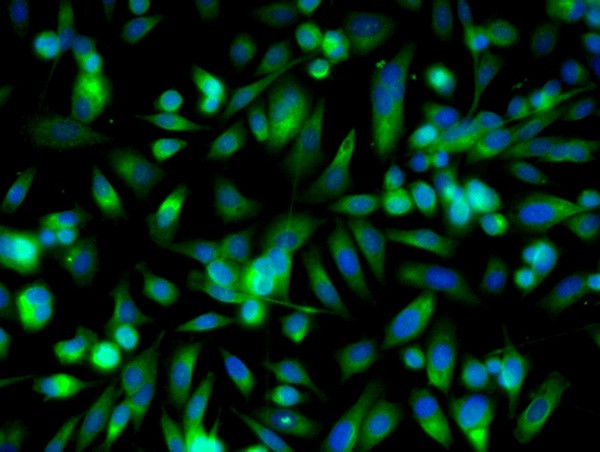 RAR Beta Antibody in Immunocytochemistry (ICC/IF)